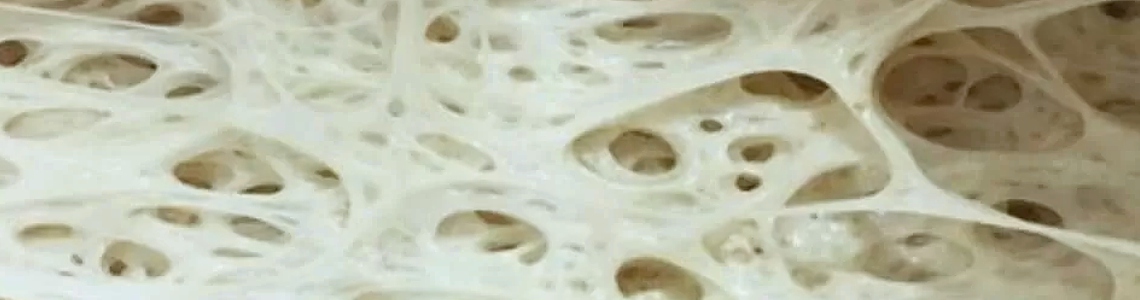 La maglia glutinica